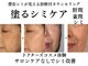 テセラ(Tethere)の写真