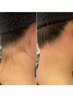 【男性限定】抜かりなくお顔とうなじWax脱毛+パック♪15000円