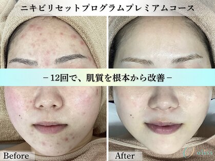 オリス 京都店(oliss)の写真