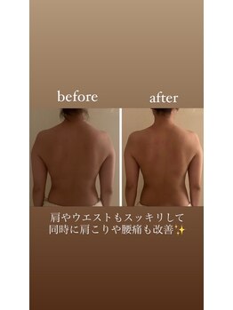 ウララカ(uraraka)/