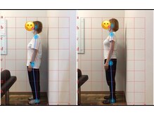 神保さるがく整骨院/姿勢のお写真の撮影