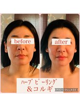 ウルワシ(Uruwashi)/★ビフォーアフター★