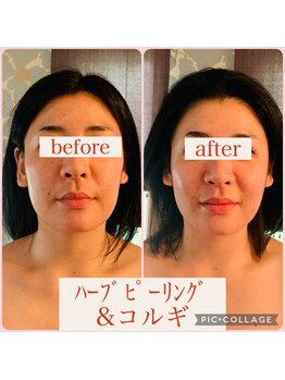 ウルワシ(Uruwashi)/★ビフォーアフター★