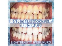 ライトビューティー 池袋店(LightBeauty)/症例写真