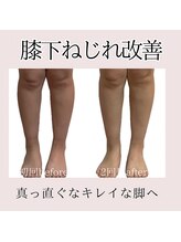 オルオル(.olu olu)/膝下ねじれ改善