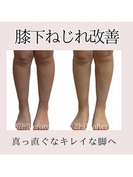 オルオル(.olu olu)/膝下ねじれ改善