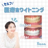 ティアナ 長崎駅前店(Tiana)