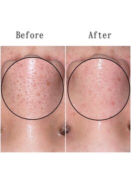 グラシア(gracia)/シミ・毛穴ケア専門店gracia