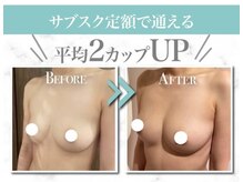 美人バスト 宇都宮店