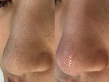 サイセイ(SAISEI)/