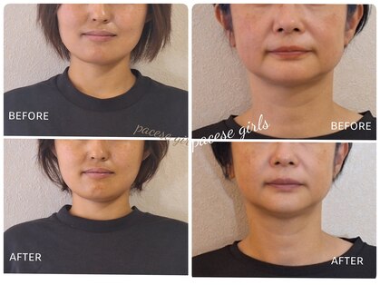 パーチェスガールズ 姪浜店(Pace-se Girls)の写真