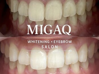 ミガク 京都四条大宮店(MIGAQ)/京都/四条大宮/ホワイトニング
