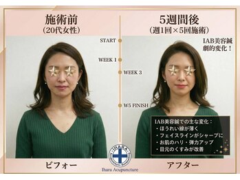 井原鍼灸整骨院/IAB美容鍼