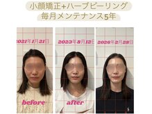 ビボーン ボディ(美bone body)/メンテナンスを続けて別人級に！