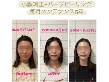 ビボーン ボディ(美bone body)/メンテナンスを続けて別人級に！