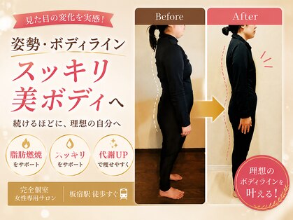 ヨサパーク マグリング(YOSA PARK Magring)の写真