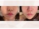 美成(vise)の写真