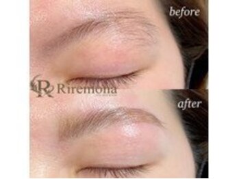 リルモナ(RIREMONA)/