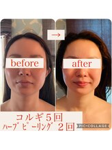 ウルワシ(Uruwashi)/★ビフォーアフター★