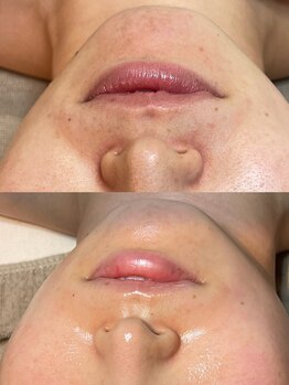 エユージュ(eyuge)/