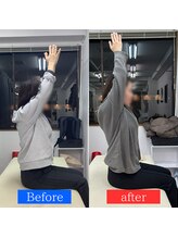 ナオル整体 神戸住吉院(NAORU整体)/20代女性　【肩こり・猫背】