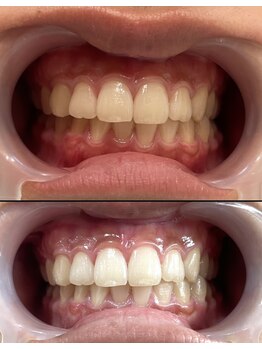 ホワイトニングセンター 大阪羽曳野店/