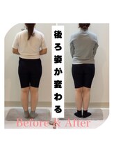 スタイルラボ高松/骨盤矯正の効果♪