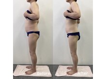 アーチ(AR-CH.)/ウエスト