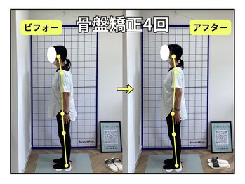 岡町おうち鍼灸整骨院/骨盤矯正ビフォー・アフター