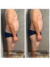 きこりのいずみ/男性の痩身も歓迎です