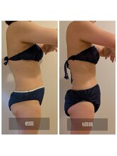 フォーエリミスプラス(for elims+)/【お客様の変化】