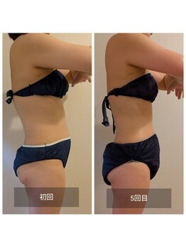 フォーエリミスプラス(for elims+)/【お客様の変化】