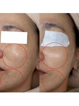 お肌想いラボ/【敏感肌の方必見】