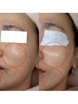 お肌想いラボ/【敏感肌の方必見】