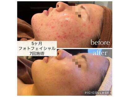 サロン ド フェイス モアナ(Salon de Faith Moana)の写真