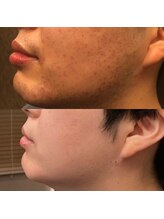 フェリーバ(FELIVA)/お肌が変わります