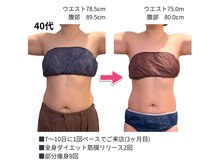 アマテ(Amate)/40代のダイエットエステ