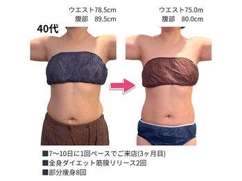 アマテ(Amate)/40代のダイエットエステ