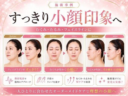 すっぴん美肌研究所 梅田本店の写真