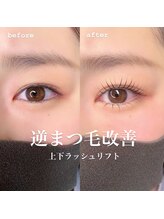 アイズ(i's)/〔上下ラッシュリフト〕