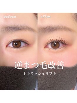 アイズ(i's)/〔上下ラッシュリフト〕