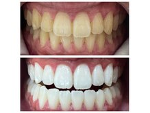 無加工のビフォーアフターです◎