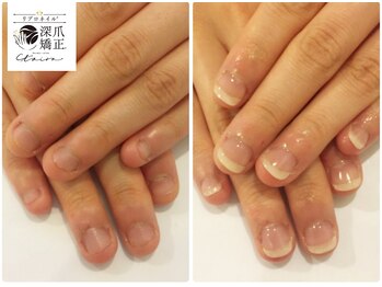 トイロ(toiro)/自爪風で周りに気づかれずに