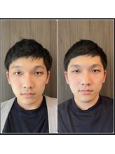 ククナ 桜木町駅前/小顔矯正ビフォーアフター　