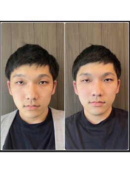 ククナ 桜木町駅前/小顔矯正ビフォーアフター　