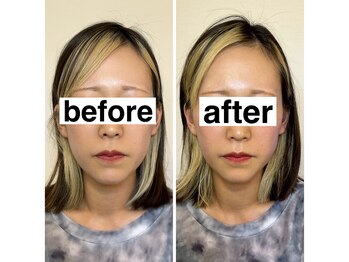 ベルガ 福岡店(Bellega)/