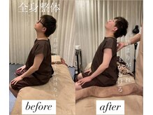 ヤマモト 表参道院(YAMAMOTO)/ストレートネック　首痛　頭痛