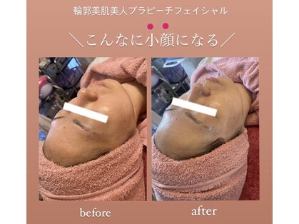 ティーダ(Ti-Da)の写真