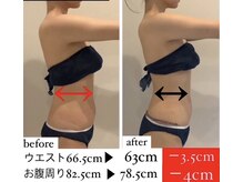 美容整骨小顔ラボ/ハイパー筋膜痩身