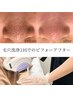 【平日限定/この春褒められる肌作り】全顔３D毛穴洗浄＋顔無VIO込全身脱毛